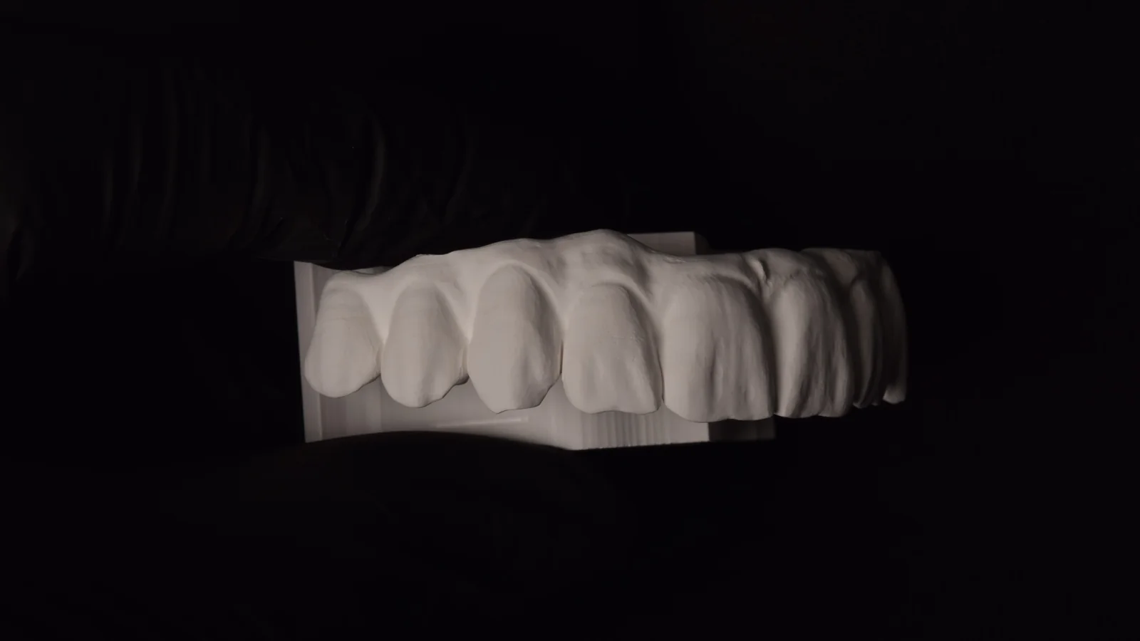CAD/CAM digitalno dizajniranje