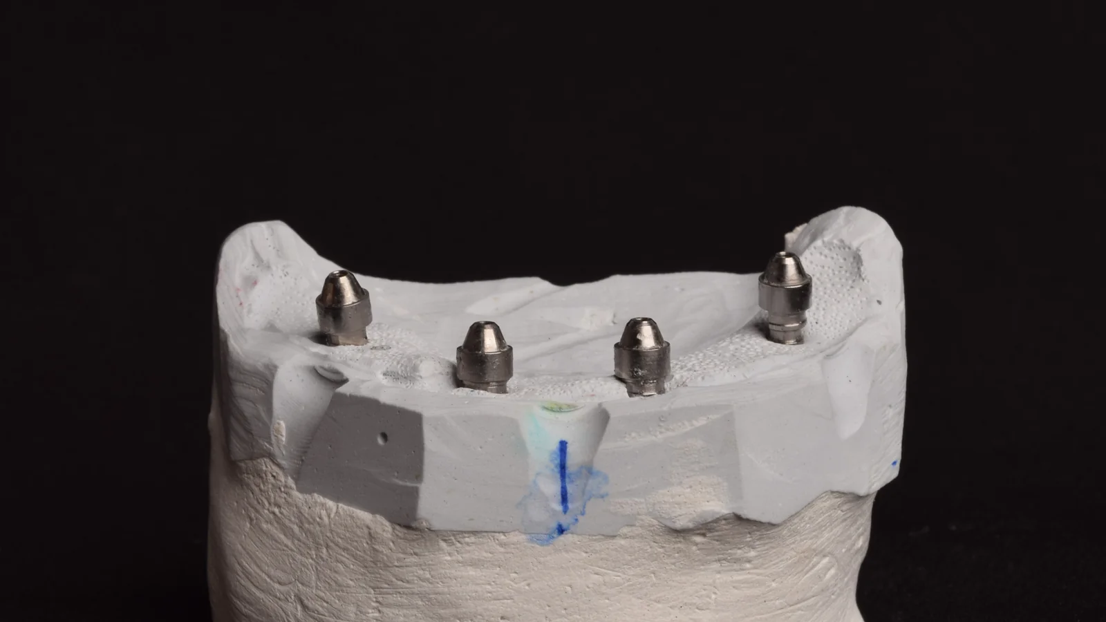 Prečka implantati 1