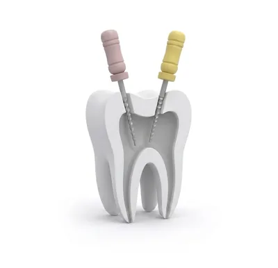 Endodoncija